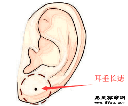 旺财痣, 身上此处长善痣, 发横财, 进偏财, 看你脸上得是不是