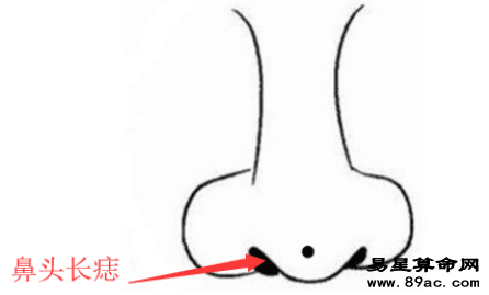 旺财痣, 身上此处长善痣, 发横财, 进偏财, 看你脸上得是不是